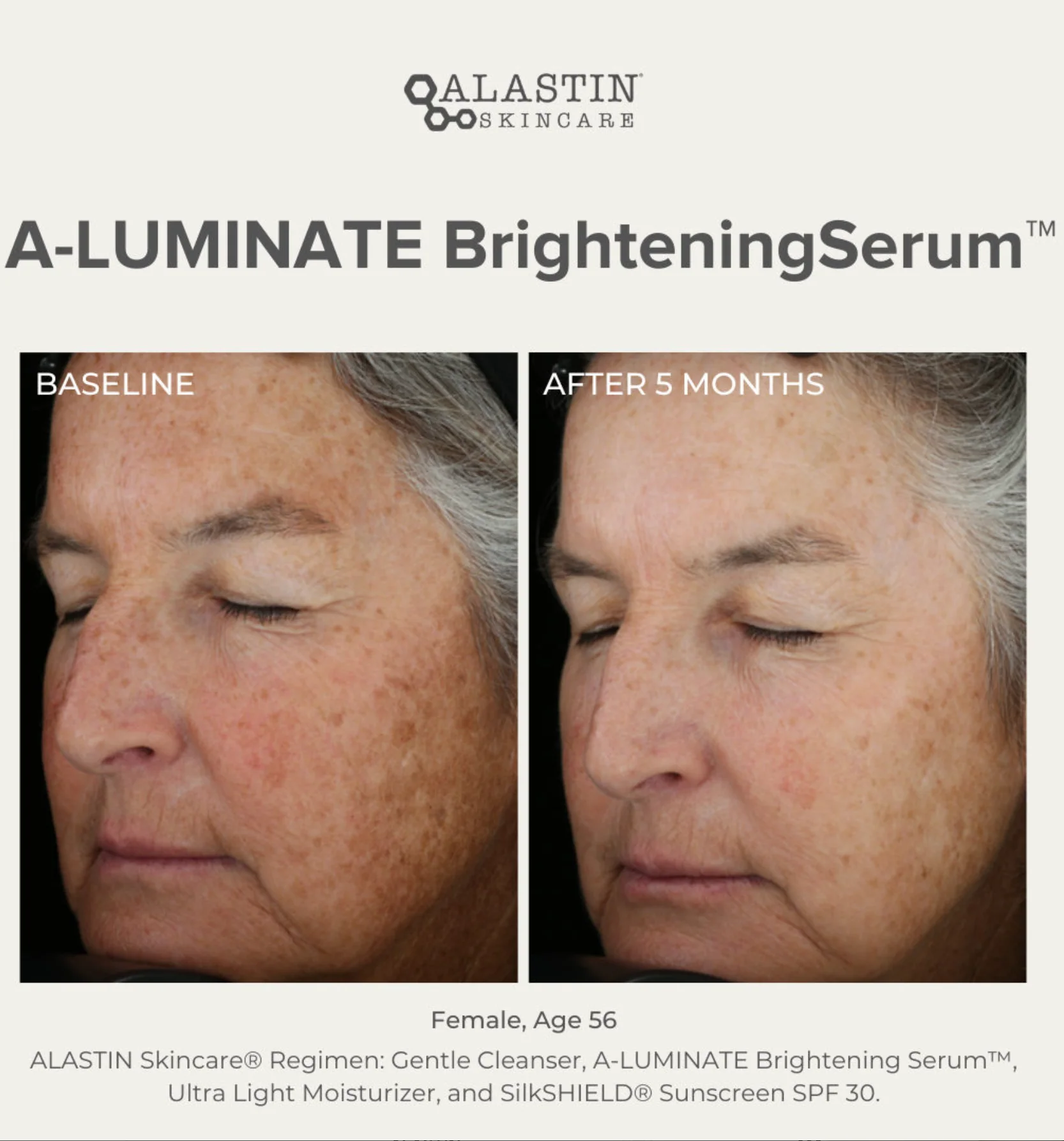 A-LUMINATE Brightening Serum 50ml - Image 4