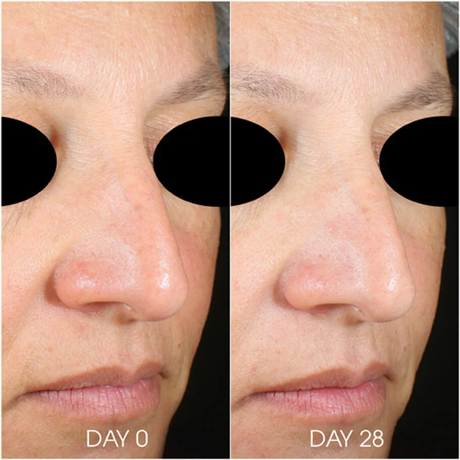 RHA® Hydra Mask 50ml - Image 5