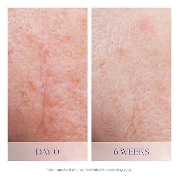 Active Serum - Image 4