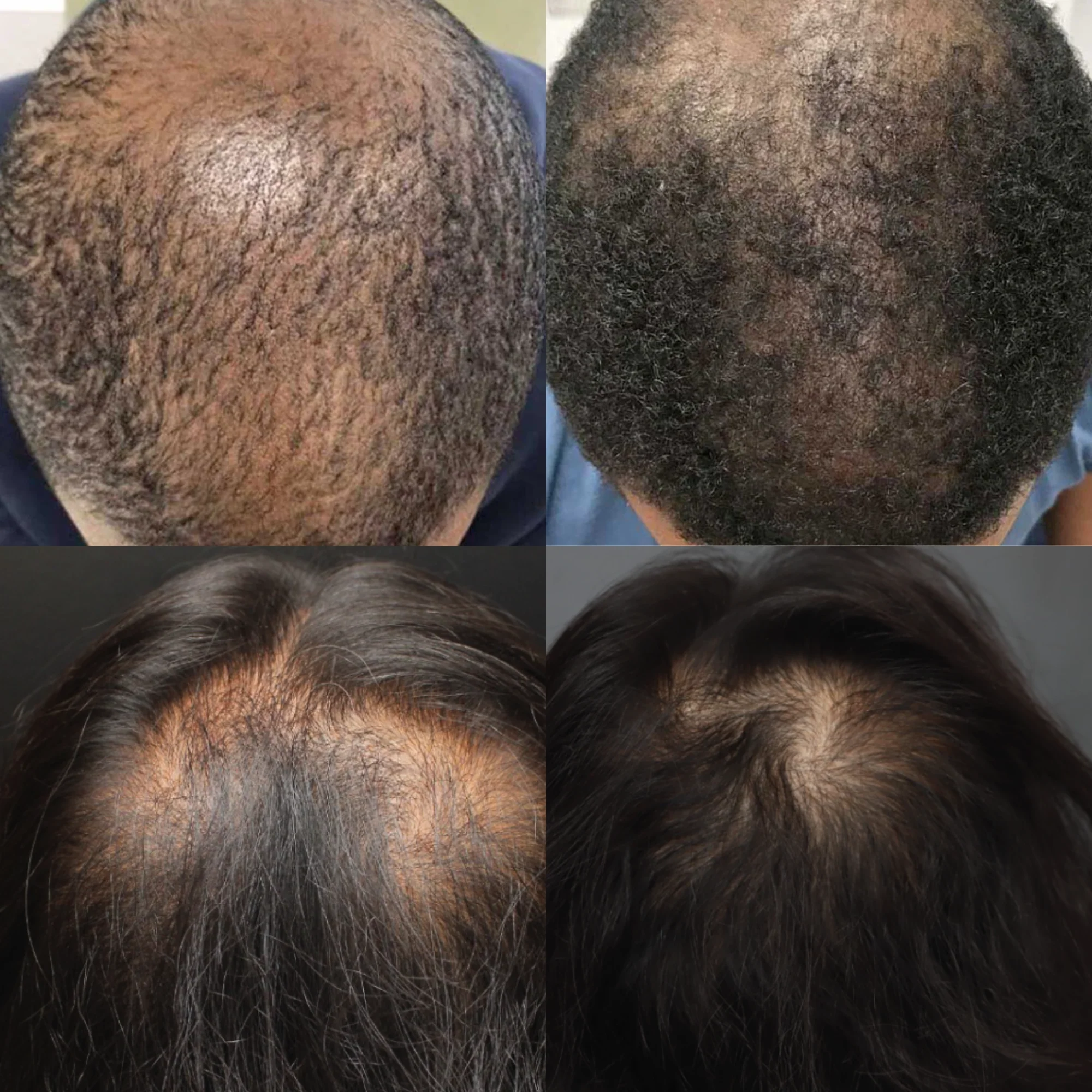 Advanced Hair System - Image 5