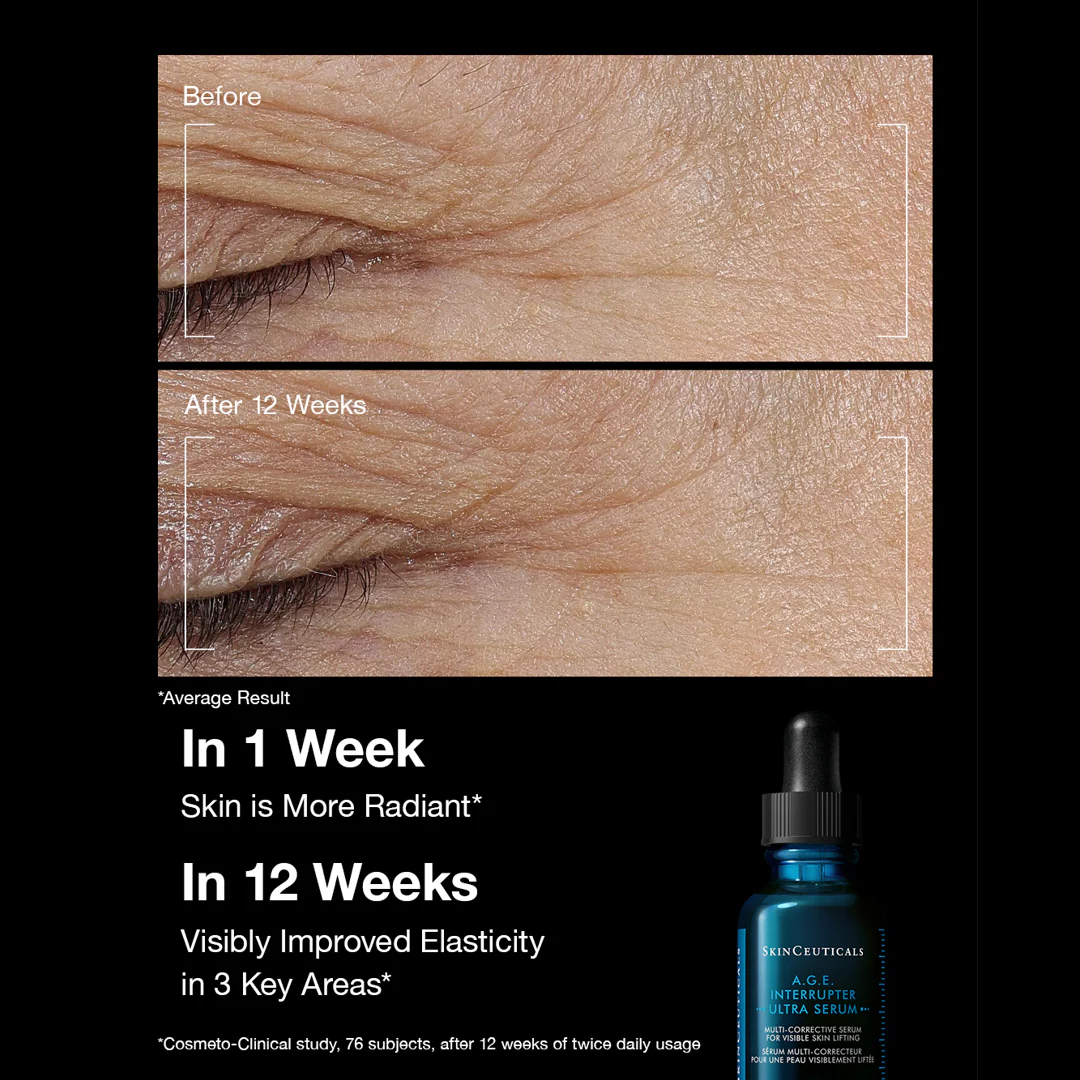 A.G.E Interrupter Ultra Serum 30ml - Image 8