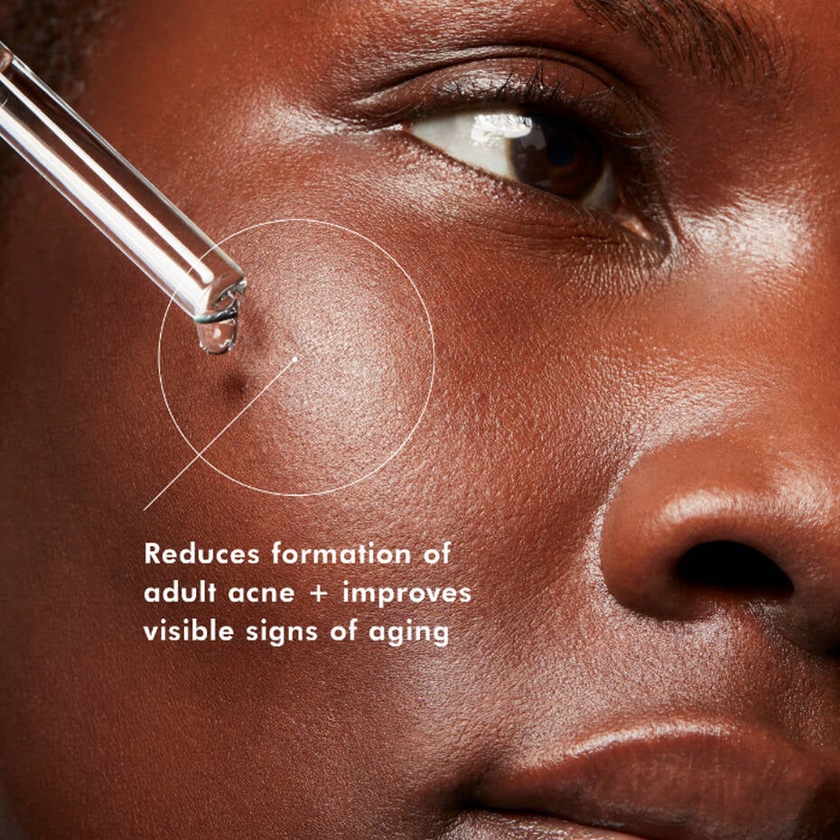Blemish and Age Defence 30ml - Image 5