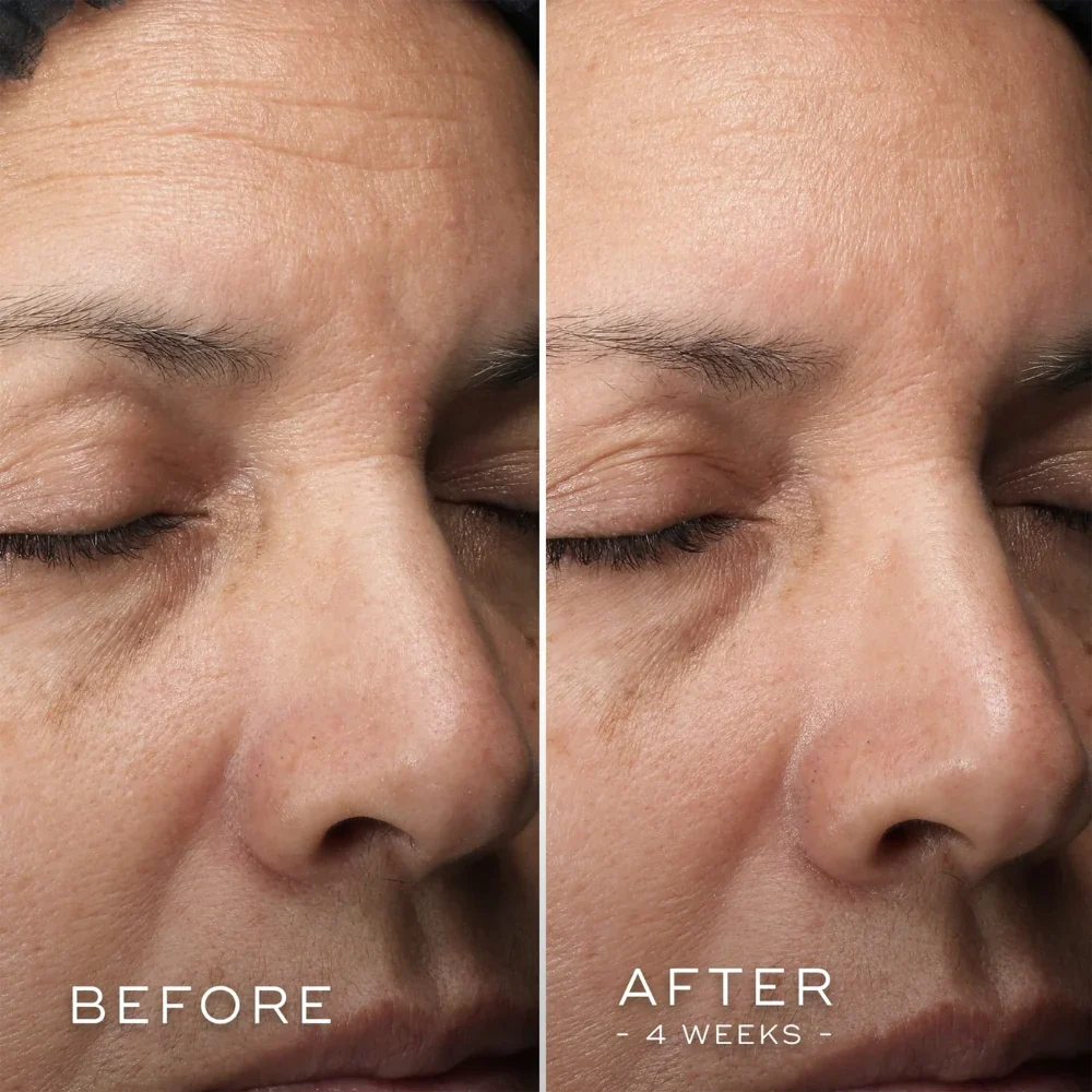 C-Tetra Luxe 30ml - Image 4