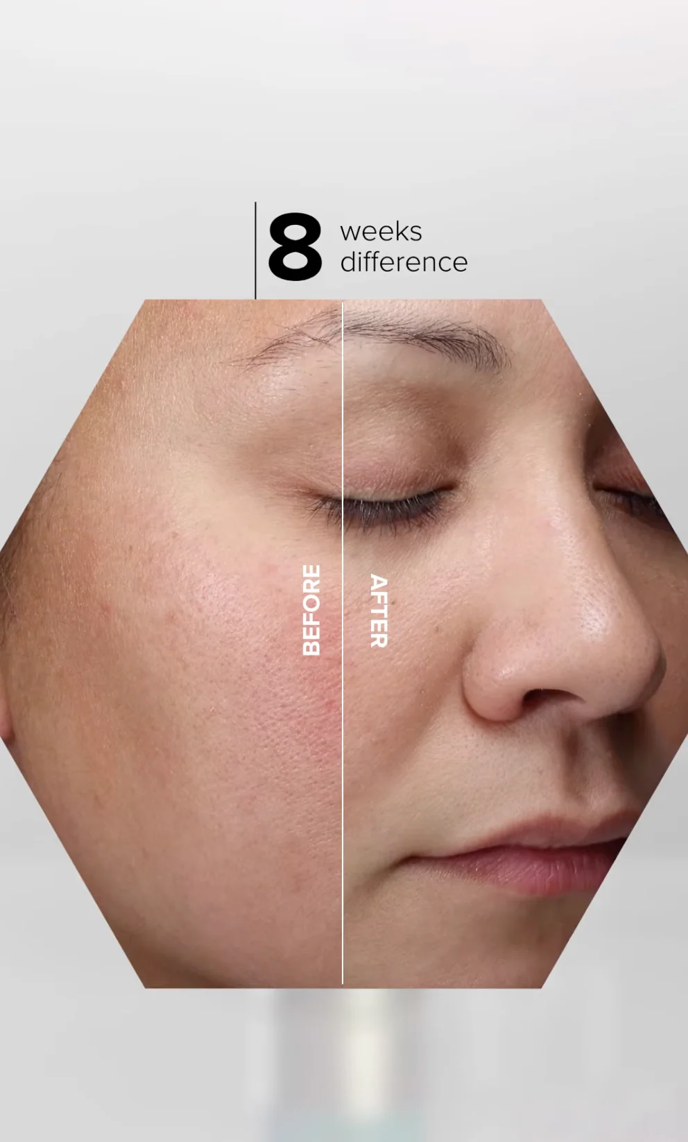 HA (Hyaluronic Acid) Immerse Serum 30ml - Image 5
