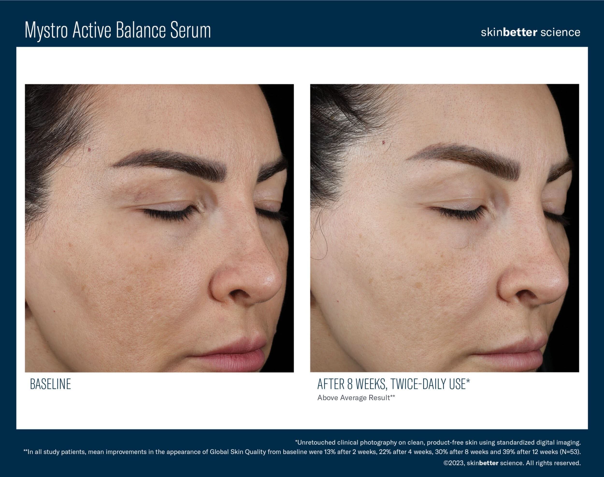 Mystro Active Balance Serum 30ml - Image 3