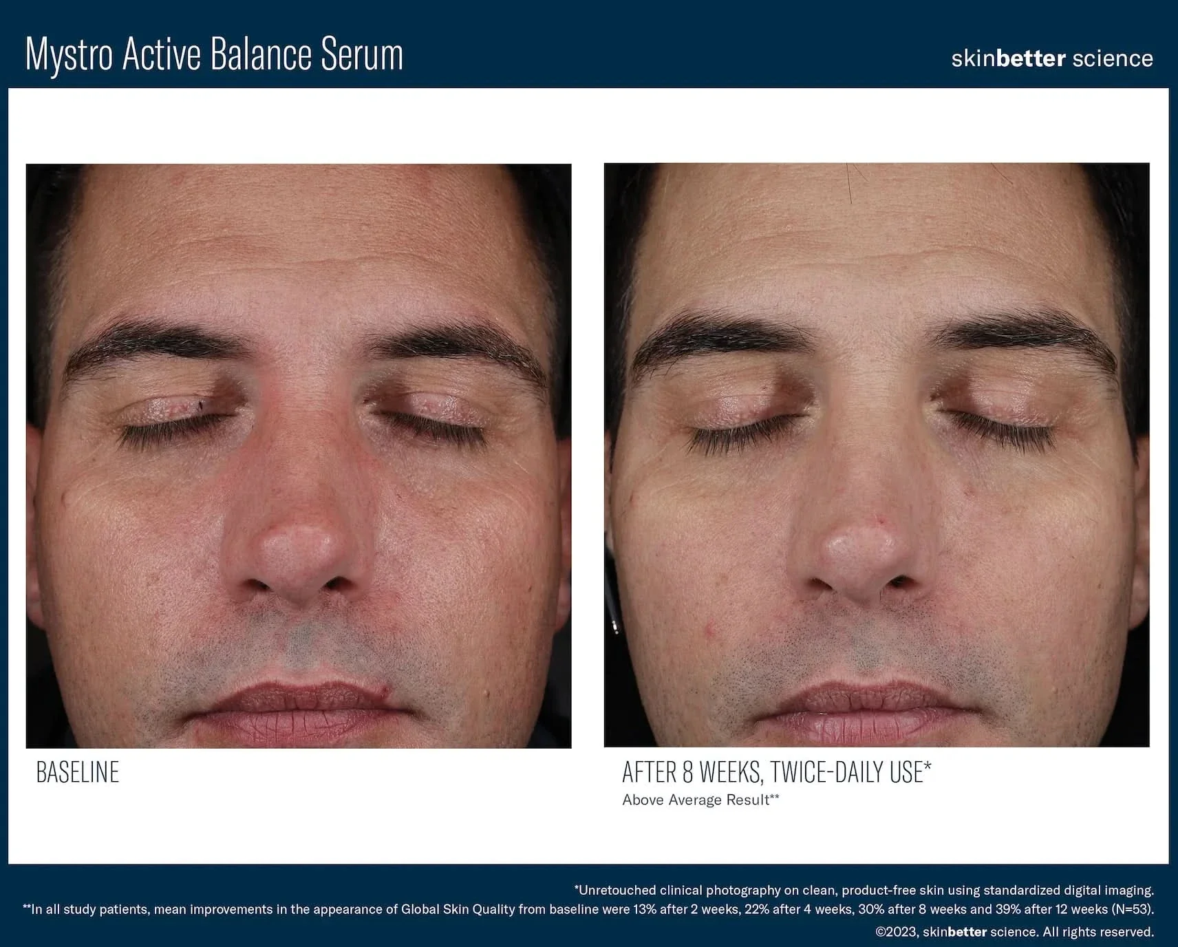 Mystro Active Balance Serum 30ml - Image 4