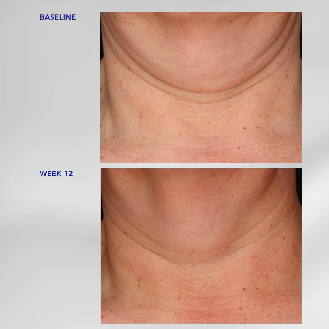 Neck Complex 50ml - Image 4