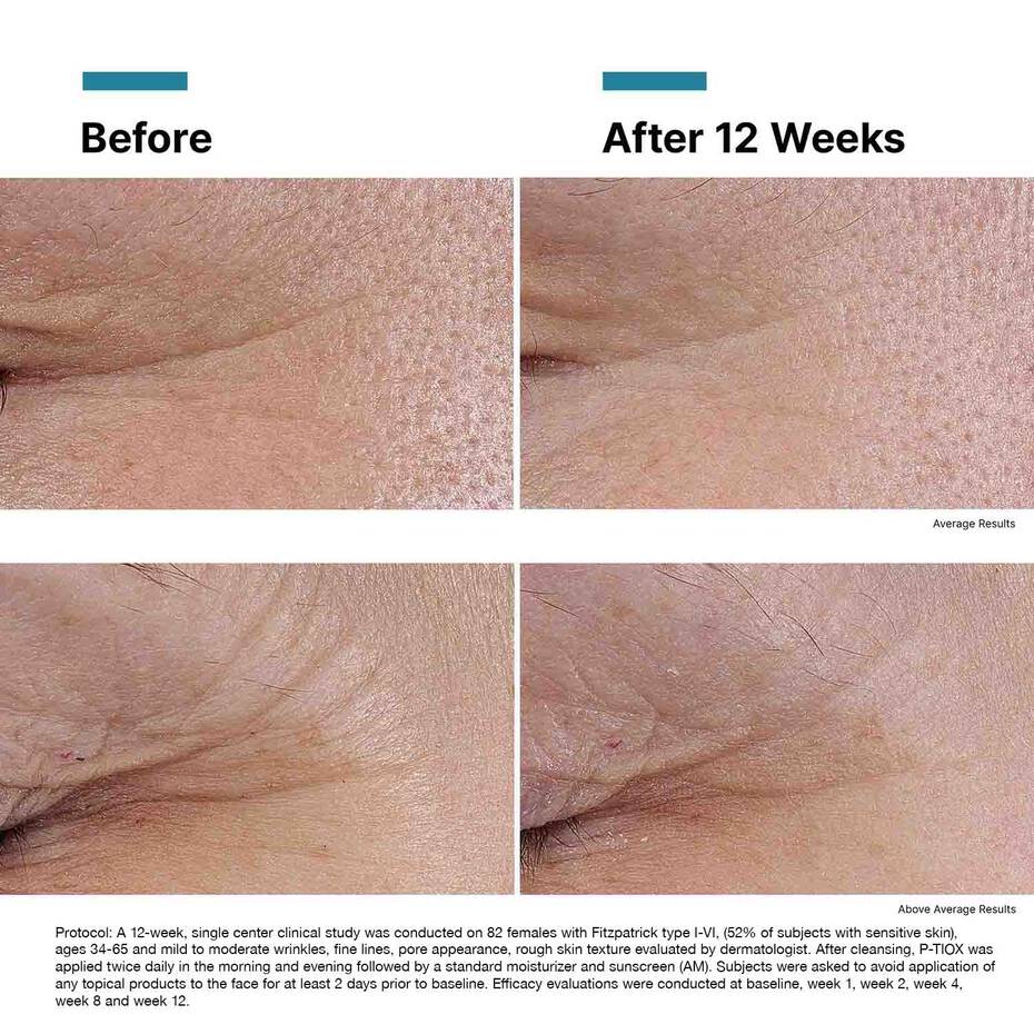 P-TIOX Peptide Serum 30ml - Image 6