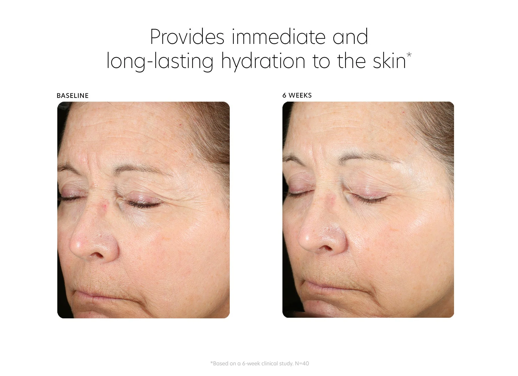 Hyaluronic Acid Boosting Serum 30ml - Image 4