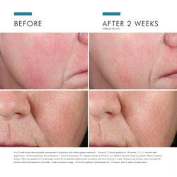 Phyto Corrective Essence Mist 50ml - Image 3
