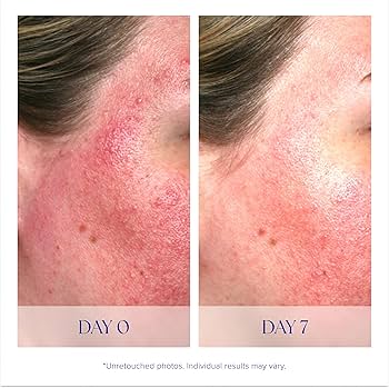 Pro-Heal Serum Advance+ - Image 5