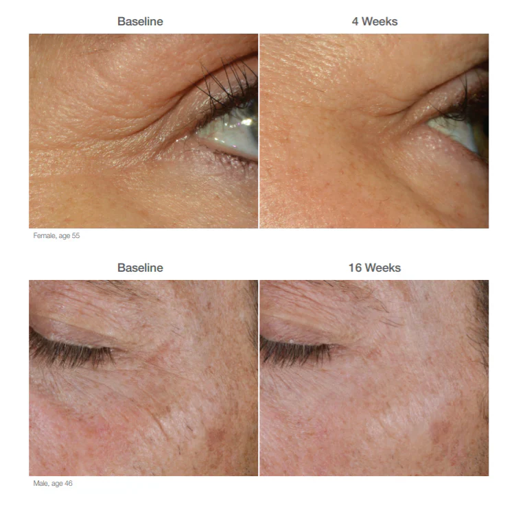 Restorative Eye Complex 18ml - Image 4