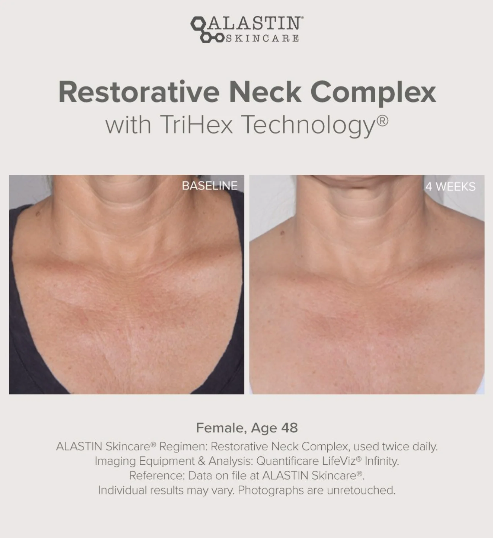 Restorative Neck Complex 50ml - Image 5