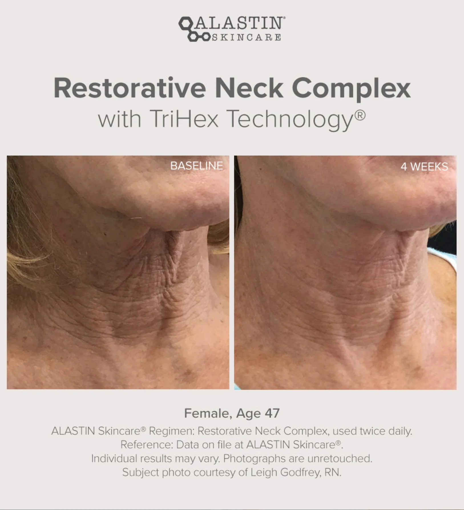 Restorative Neck Complex 50ml - Image 6