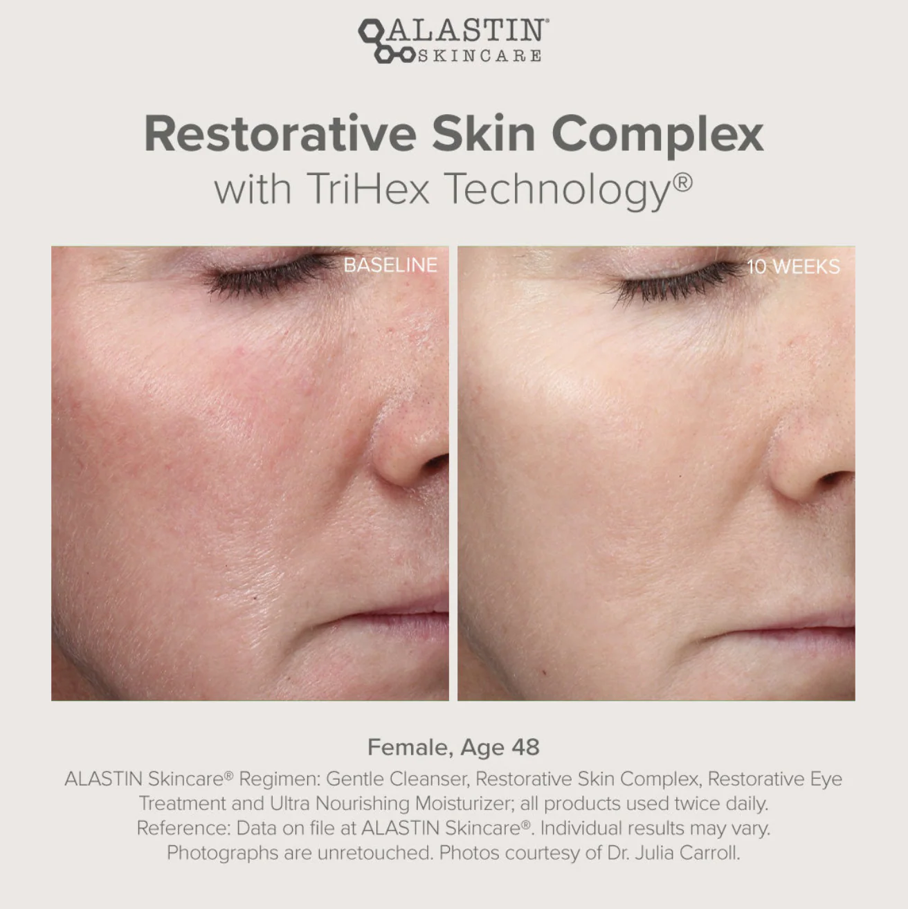 Restorative Skin Complex 29ml - Image 4