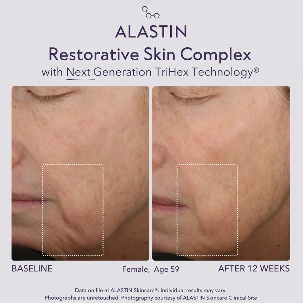 Restorative Skin Complex 29ml - Image 8
