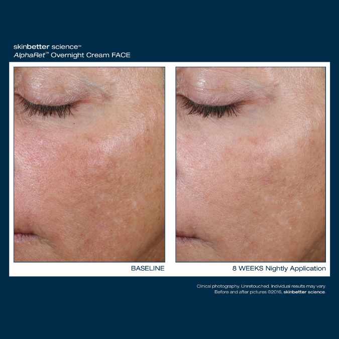 AlphaRet Overnight Cream 30ml - Image 5