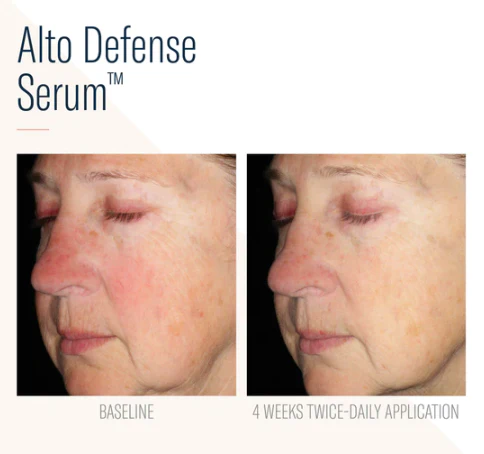 Alto Defense Serum FACE 30ml - Image 4
