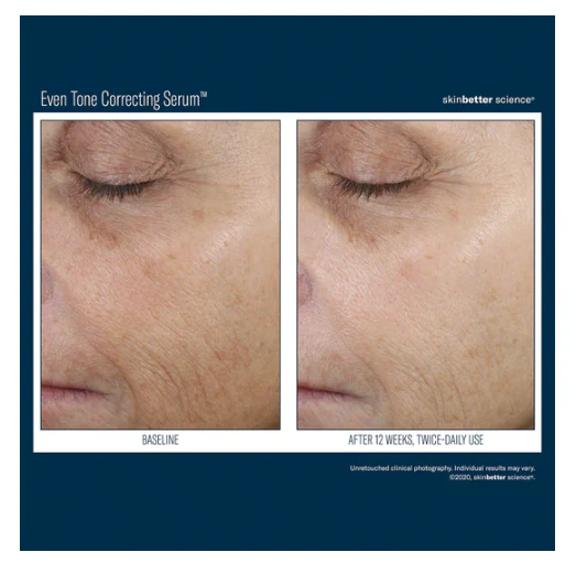Even Tone Correcting Serum 50ml - Image 4