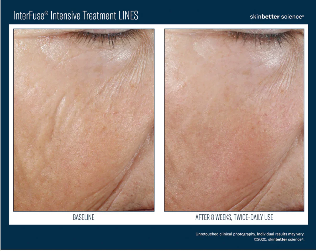 Interfuse Intensive Treatment LINES 15ml - Image 5