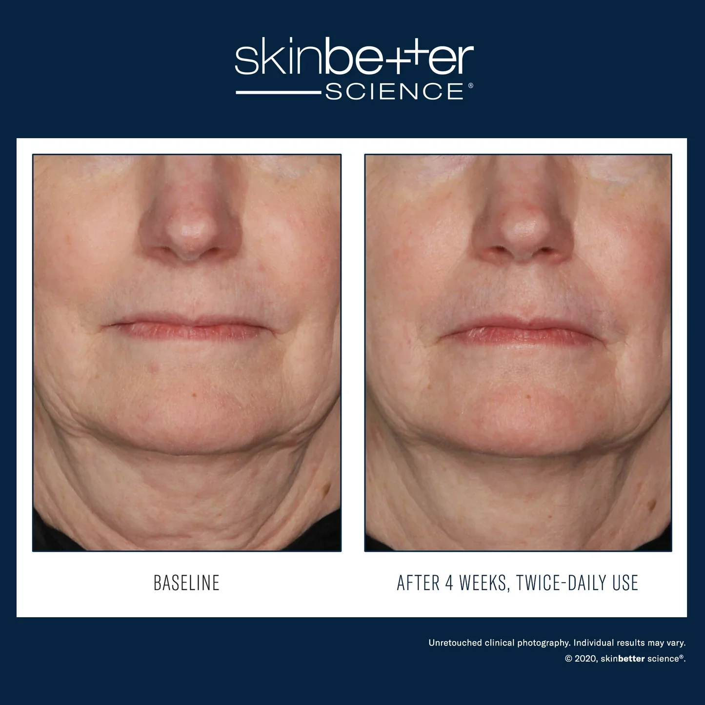 InterFuse Treatment Cream FACE 30ml - Image 5