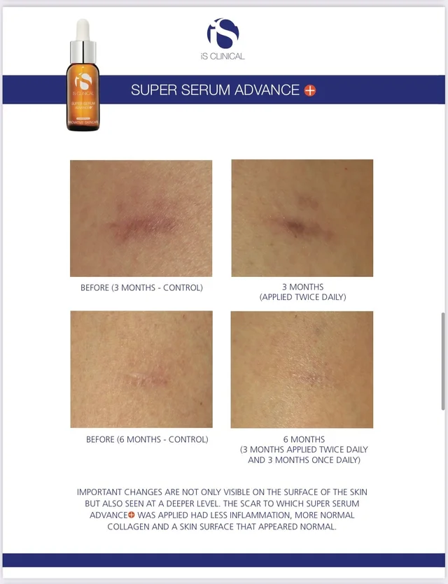 Super Serum Advance+ 15-30ml - Image 5
