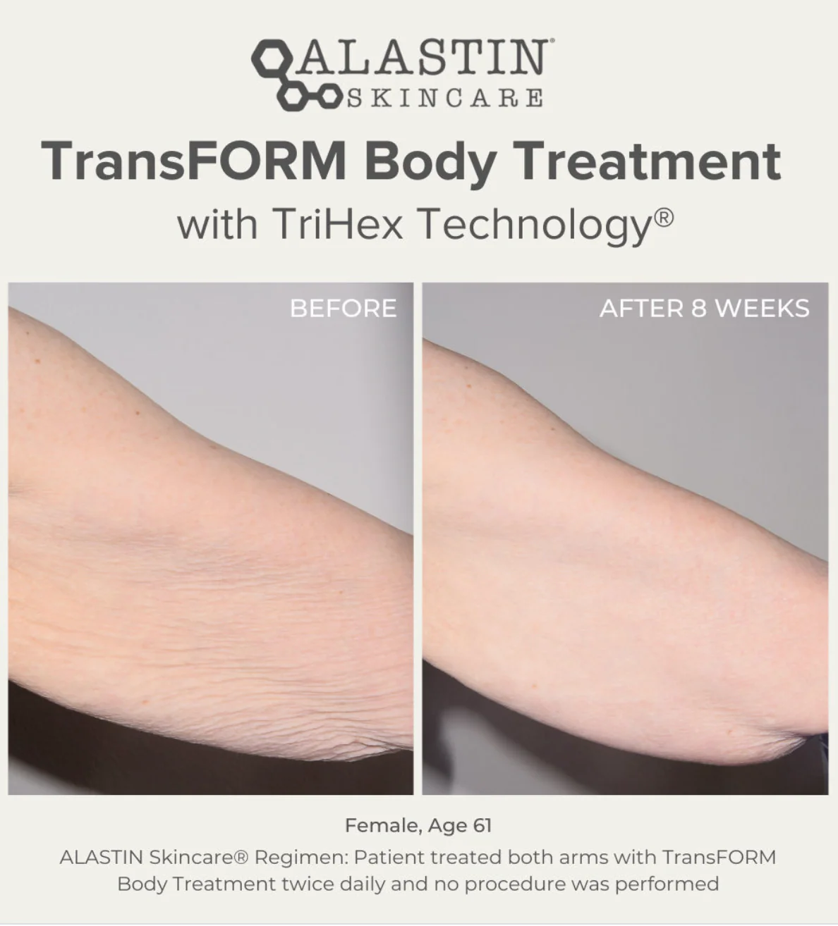 TransFORM Body Complex 170g - Image 3