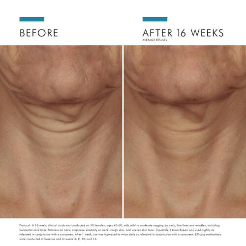 Tri-Peptide Neck Repair 50ml - Image 4