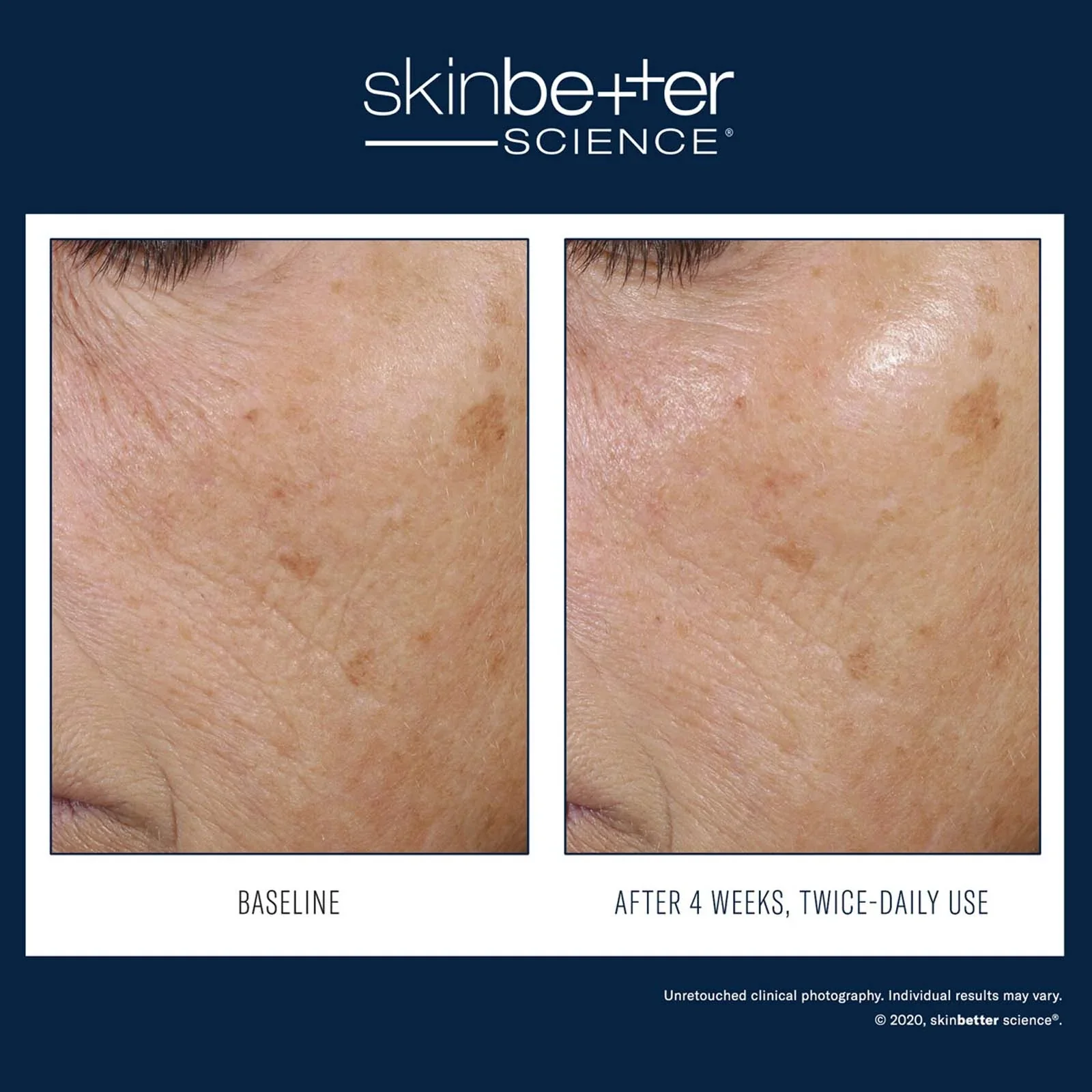 Trio Rebalancing Moisture Treatment 50ml - Image 4